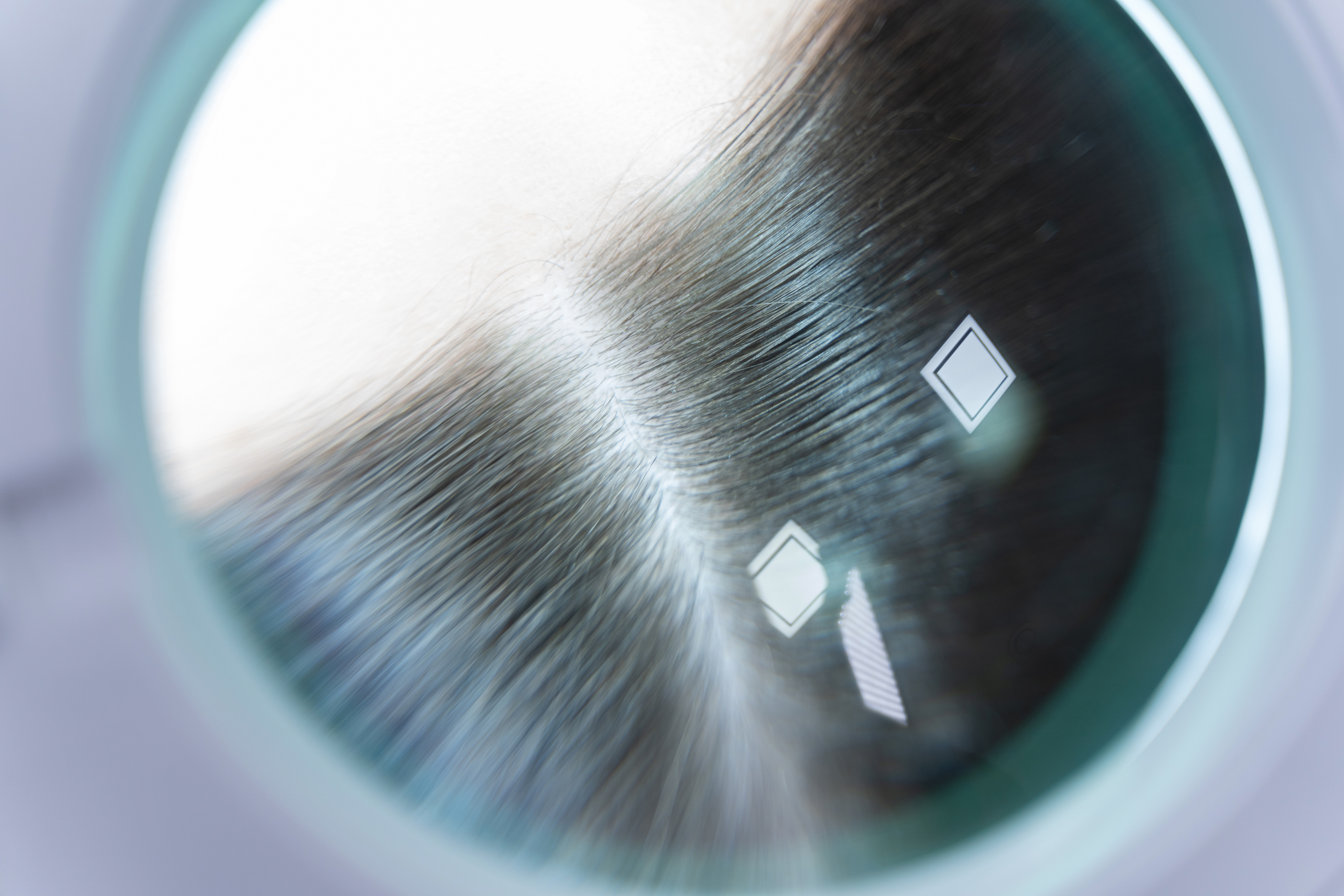 PP405 vs. NOVOGRO™: Why Salon Pros Are Questioning the Dormant Follicle Hype